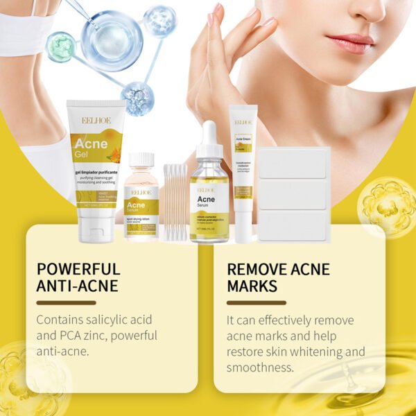 EELHOE Acne-prone Skin Care Set. Suitable for acne-prone skin care, it can make the skin tender, hydrate and moisturize the skin, and improve skin condition. - Image 4